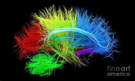 Human Brain Nerve Tracts By Thom Leach Science Photo Library