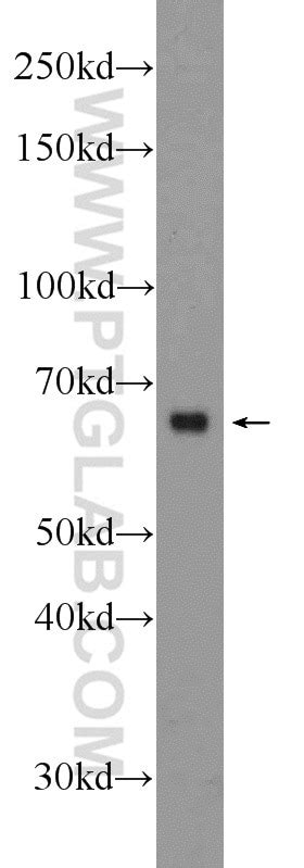 Cd Antibody Ap Proteintech