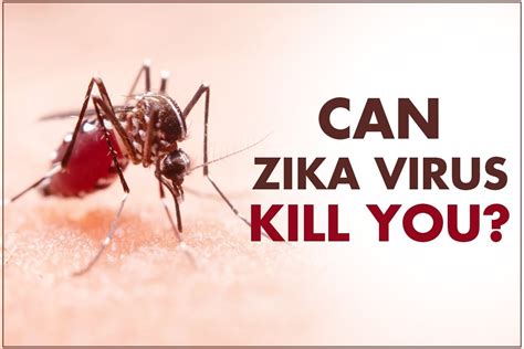 Can Zika Virus Kill You 4 Rare Conditions It Can Cause In Infected