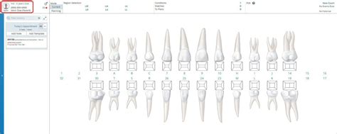 Default Dentition by Age for the Hard Tissue Chart or Dental Chart ...