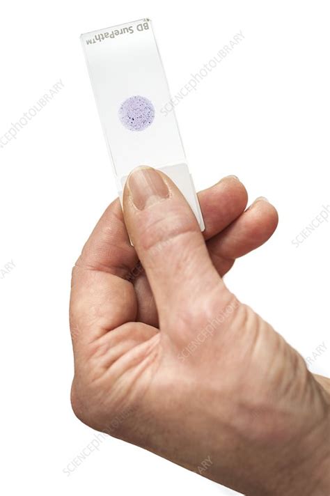 Cytology Laboratory Stock Image C0232921 Science Photo Library