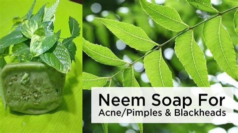 Neem Soap For Acne Pimples And Blackheads Youtube