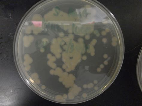Team:Brown-Stanford/REGObricks/Transforming - 2011.igem.org