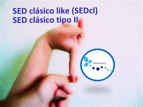 SEDcl SED clásico like SED clásico tipo II Clínica Reumatológica