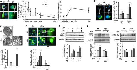 Autophagy Is Induced At Early Steps Of HIV 1 Infection A