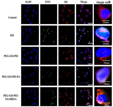 Cellular Uptake Of Different Nanocomplexes Confocal Laser Scanning