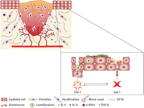 Shows the stages of re-epithelialisation during wound healing ...