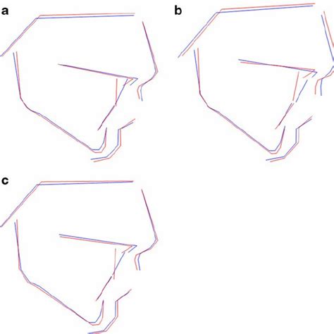 Treatment Protocols Primary Procedures For Lip Alveolus And Palate Download Table