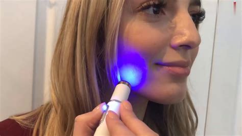 Blue Light Therapy Varicose Spider Veins Acne Removal Pen Youtube