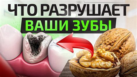 ТОП 6 самых вредных продуктов для ваших зубов. Разъедают сильнее, чем ...