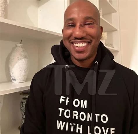 Chris Redd Has Stitches Black Eyes Following Nyc Attack