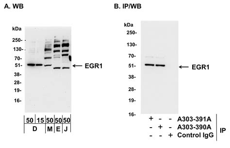 Egr1 Antibody A303 390a