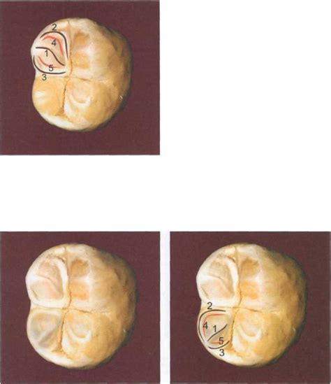 104.Художественное моделирование зубов - Стр 9