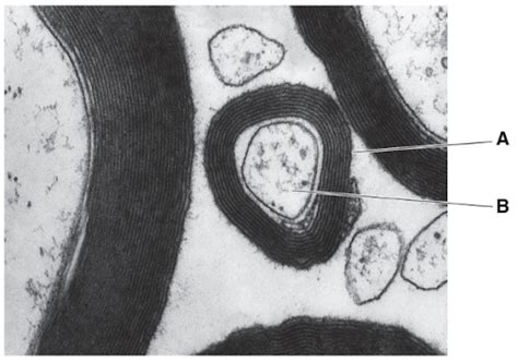 Figure given below is an electron micrograph showing a cross-section of a..