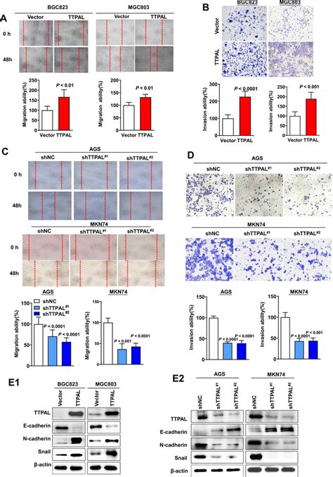 Ttpal Promoted Migration And Invasion Of Gc Cells A Representative