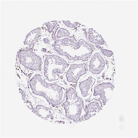 Tissue Expression Of Cd68 Staining In Testis The Human Protein Atlas