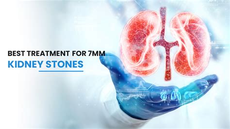 Best Treatment For 7mm Kidney Stones The Curestone
