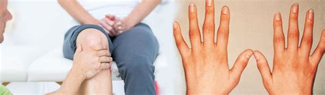 managing amavata rheumatoid arthritis  ayurveda  overview