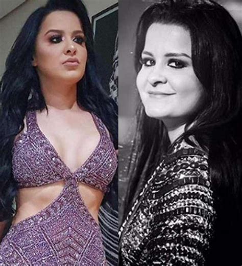 Antes E Depois As Cantoras Famosas Que Recorreram Ao Bisturi E Se