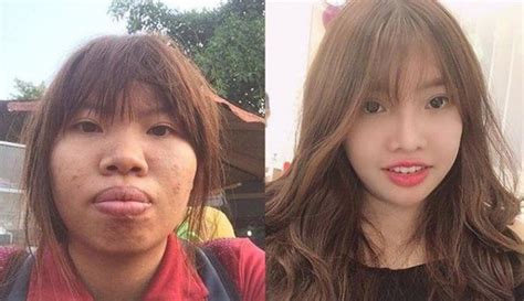 Những hot girl mạng xã hội thành danh nhờ dao kéo trùng tu đổi mặt đổi luôn cả cuộc đời