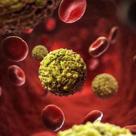 dengue virus    severe     decades