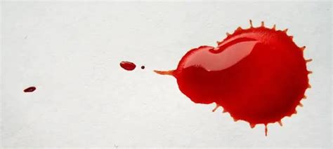 types  bleeding  symptoms  treatment types  bleeding