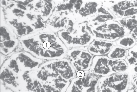 Microstructure Of Hepatopancreas Lymnaea Auricularia Control