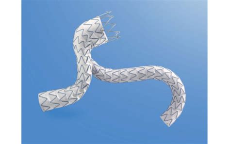 Medtronic Launches Chevar Parallel Graft Technique Study Using Endurant