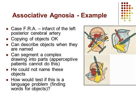 Apperceptive Visual Agnosia