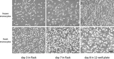 Culture Of Macrophage Colony Stimulating Factor Differentiated Human