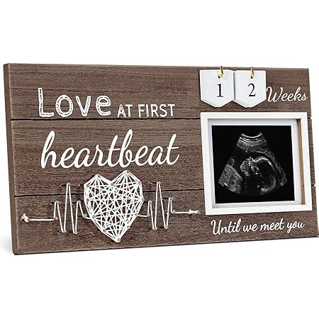 Amazon Ultrasound Picture Frame Cherish The Miracle Sonogram