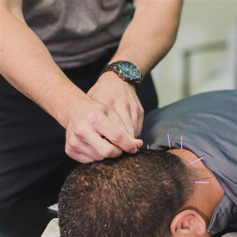 Dry Needling Services - Peak Physical Therapy | Helena, MT