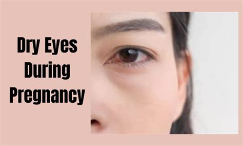 Understanding And Managing Dry Eyes During Pregnancy [ February 2024 ]