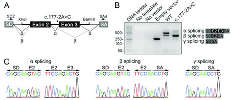 The variant c.177-2A>C causes exon 3 skipping during TG pre-mRNA ...