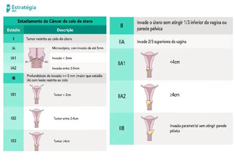 Resumo de câncer de colo de útero diagnóstico tratamento e mais