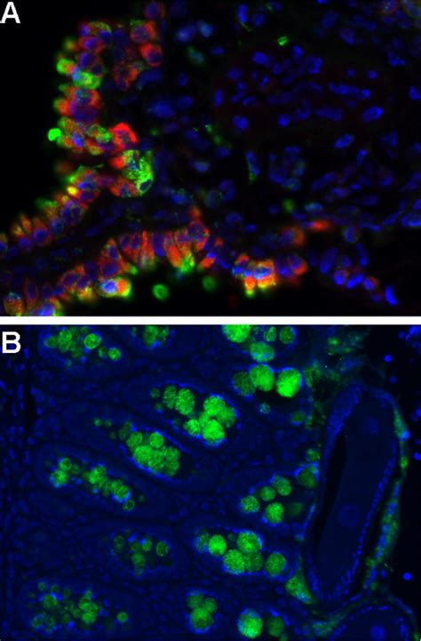 Cellular Interactions In The Immune Response To Helminths Helminths