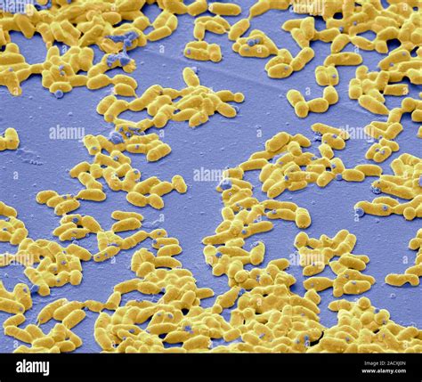 Corynebacterium Diphtheriae Coloured Scanning Electron Micrograph Sem