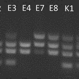 Gel Showing Multiplex PCR Amplification Of DNA For The Detection Of The