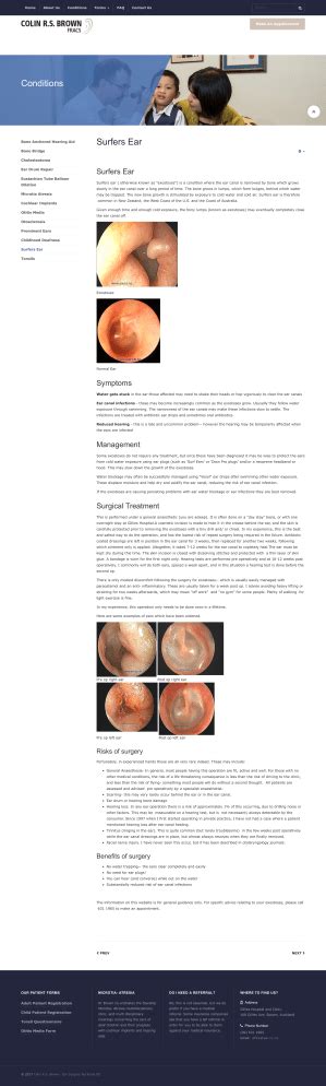 Surfers Ear Symptoms Treatment And Surgery