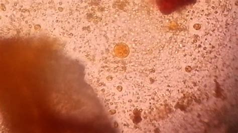 Entamoeba Coli Cyst Wet Mount