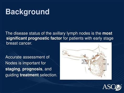 Ppt Sentinel Lymph Node Biopsy In Early Stage Breast Cancer