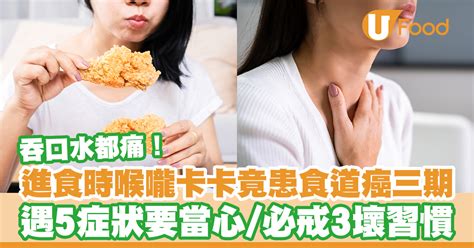 吞口水都痛！喉嚨卡卡竟患食道癌三期 遇5症狀要當心／必戒3壞習慣 U Food 香港餐廳及飲食資訊優惠網站