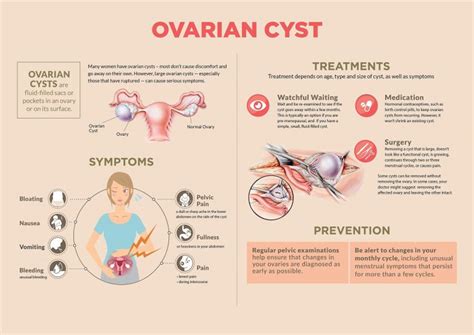 Ovarian Cyst Dr Rimmy Singla Singla Mediclinic