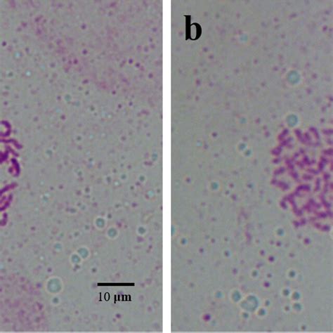 Chromosome count of diploid and tetraploid. a diploid; b tetraploid ...