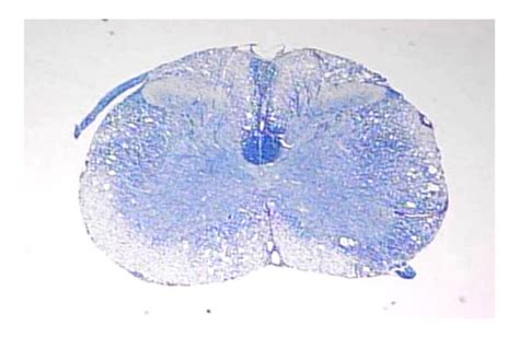 Theiler S Murine Encephalomyelitis Virus Tmev Induced Demyelination