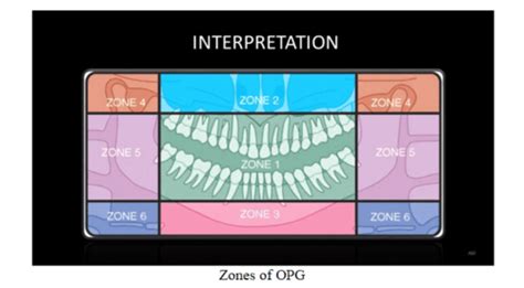 Panoramic Radiographic Anatomy Week Radiology Flashcards Quizlet