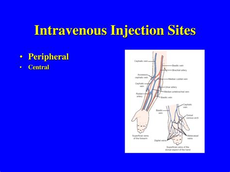 Iv Injection Sites Diagram Arm