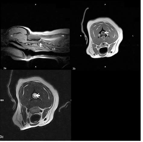 A T1 Weighted Spin Echo Sequence Image In Sagittal Plane B