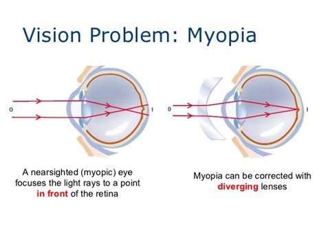 Diverging Lens Science Facts