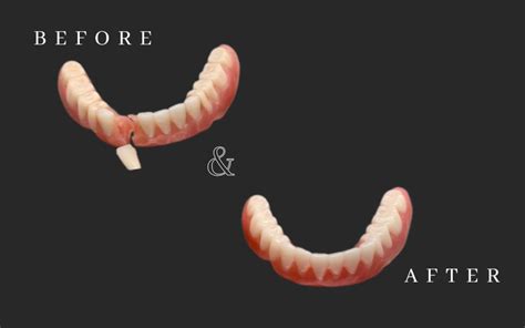 5 Quick Fixes To Save A Wobbly Smile